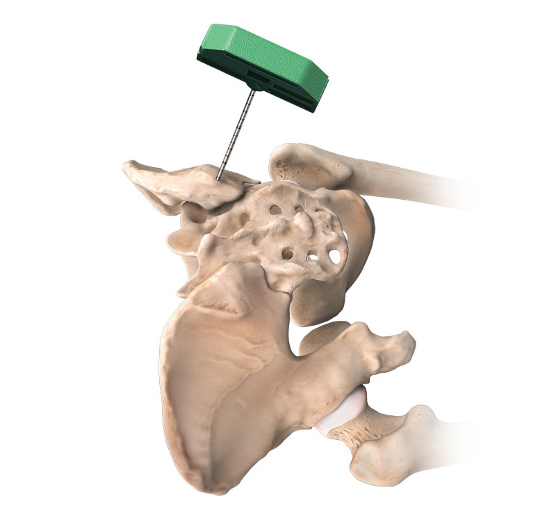 ゴアグラインド Septic Autopsy アルバムセット 51L2a3nptRL._SY200_QL15_.jpg